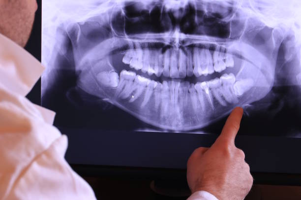 Best Pediatric Emergency Dentist in Vineyard, CA